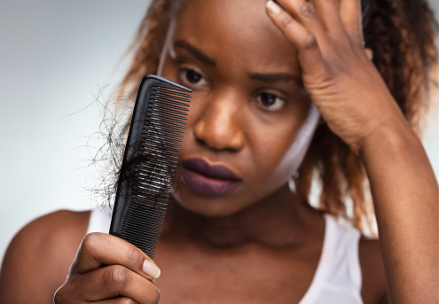 Comment lutter contre l'alopécie des cheveux crépus, frisés et bouclés !